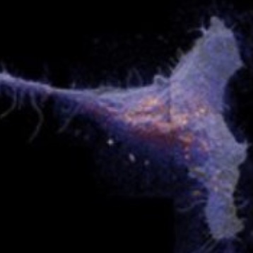 Ultra-High Vacuum Secondary Ion Mass Spectronetry for the Analysis of Lipid Species and Cholesterol