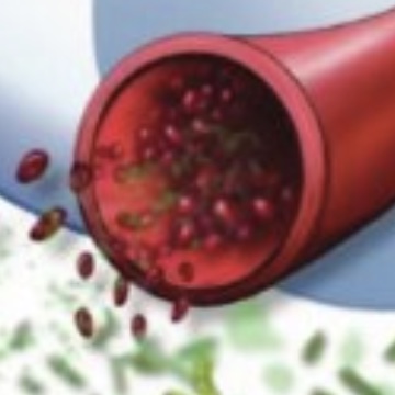 In Search of Acute Ischemic Stroke Biomarkers 